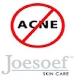 JOESOEF SKIN CARE Sulfur Soap for Acne, 100G, Dermatologist Approved, Yellow, Model SS101