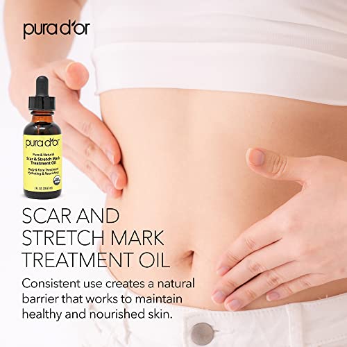 PURA D'OR Organic Scar & Stretch Mark Treatment Oil (1oz) For Skin - With Rosehip, Wheat Germ, Argan, Tamanu, Carrot, Rosemary,