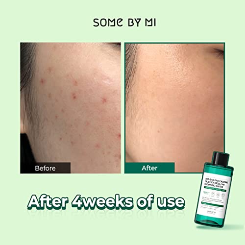 Some By Mi Aha Bha Pha Calming Truecica Micellar Cleansing Water / 10.14Oz, 300Ml / Mild Daily Cleansing Water For Sensitive Ski