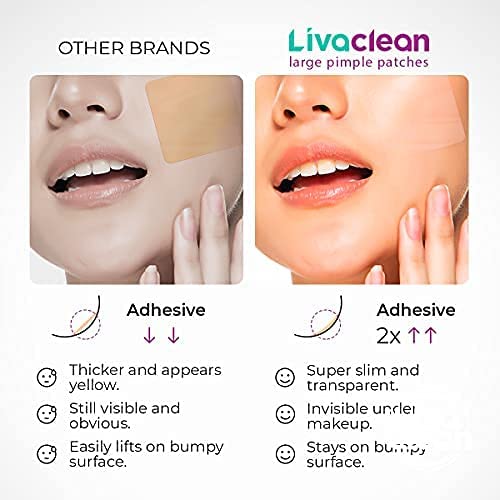 LivaClean 20 CT Large Hydrocolloid Acne Patches - For Pore Spots Nose Face Cystic Pimple Zit Patch - Big Pimple Patches Hydrocol