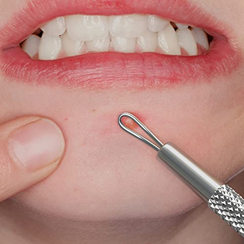 Suvorna White Head Remover for Face, Pimple Extractor, Pimple Popper, Whitehead Remover for Face, Comedone Extractor Tool, Pimpl