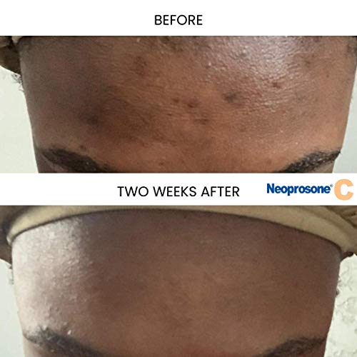 Neoprosone, Vitamin c Serum for Face  1 Fl oz  30ml  For Dark circle, Wrinkles & Dark Spots, Hyperpigmentation Serum  with Alpha