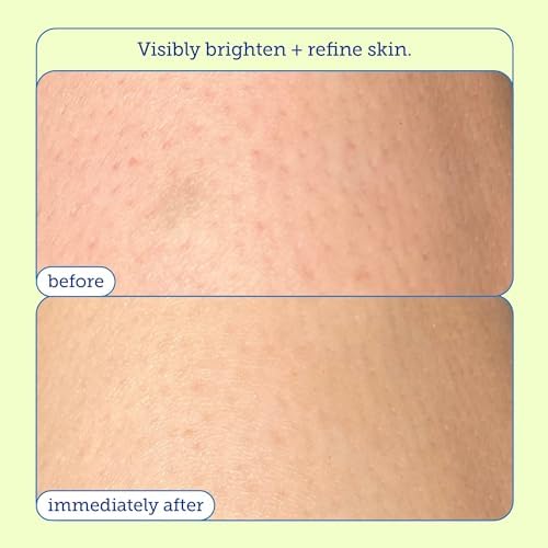 Skinfix Resurface+ Glycolic Renewing Scrub: A Double-Duty Aha Bha Exfoliant Scrub & Body Peel To Visibly Polish, Refine, Brighte