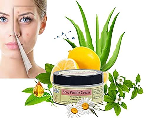 Khadi Rishikesh Ayurvedic Anti Acne Pimple Removal Face Cream For Reduce Acne Scars & Marks Cream Controls Acne, Pimples Reduc