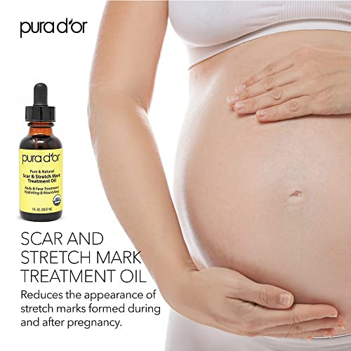 PURA D'OR Organic Scar & Stretch Mark Treatment Oil (1oz) For Skin - With Rosehip, Wheat Germ, Argan, Tamanu, Carrot, Rosemary,