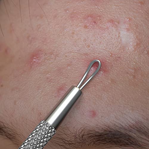 Suvorna White Head Remover for Face, Pimple Extractor, Pimple Popper, Whitehead Remover for Face, Comedone Extractor Tool, Pimpl