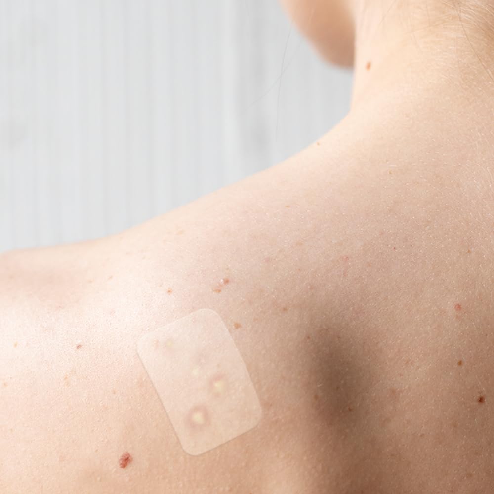 Truly Clear Target Patches For Face & Body - Hydrocolloid Acne Spot Stickers For Zits And Blemishes, Vegan, Cruelty-Free Acne So