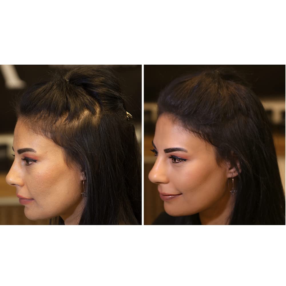 Fixdeep Hair Thickener - Waterproof Fibers for Thinning Hair, 14g, Dark Brown