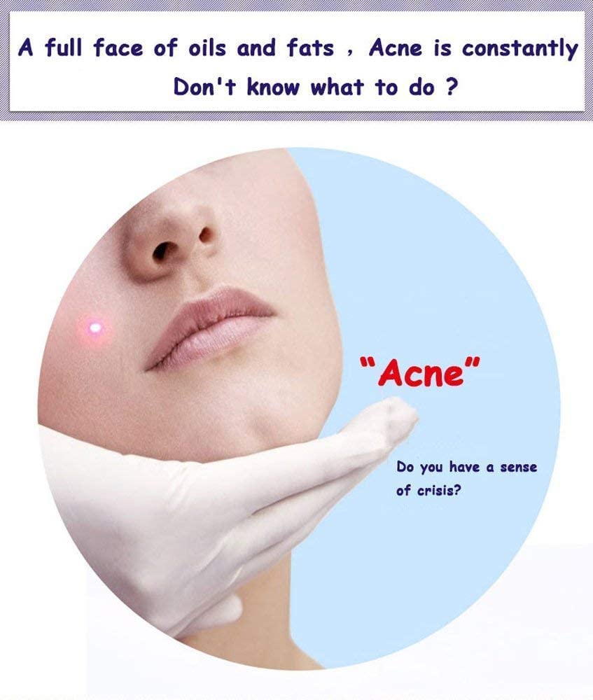 BIOAQUA Face Acne Treatment Scar Removal Spots Pimples Moisturizing Essential Oil 30ml