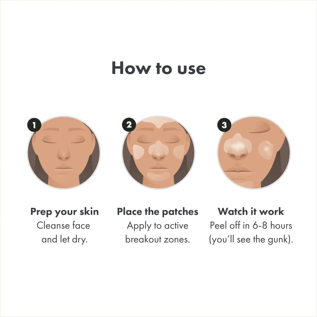 Mighty Patch Face Patch From Hero Cosmetics - Xl Hydrocolloid Face Mask For Acne, 5 Large Pimple Patches For Zit Breakouts On No