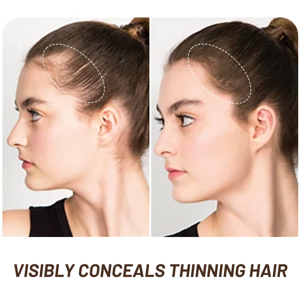 Volluck Root Touch Up Powder, Instant Hairline Powder For Thinning Areas And Gray Hair Coverage, Natural And Non-Greasy Root Cov