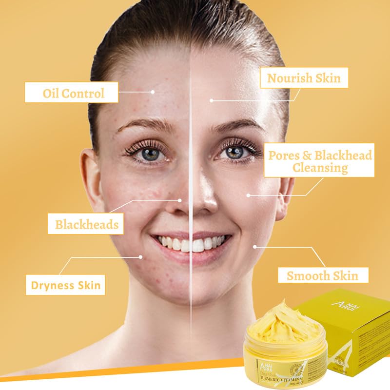 ANAIRUI Turmeric Vitamin C Clay Mask for Dark Spots, Vitamin C Clay Facial Mask for Blackheads, Pores, Wrinkles, Fine Lines, Hyd