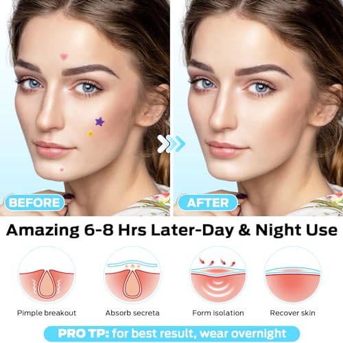 VOZRO Pimple Patches, Colorful Hydrocolloid Acne Patches for Face, Cute Star Pimple Patches with Salicylic Acid, Tea Tree & Cent