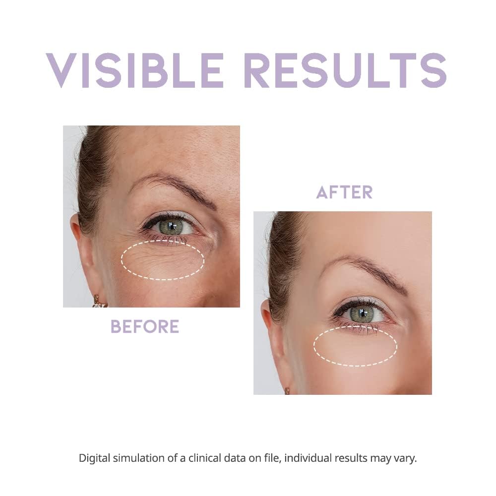 #Ootd Eye Cream For Dark Circles Puffiness And Bags Anti Aging Wrinkles Korean Cream Peptide, Vitamin C, Collagen, Vegan Under E