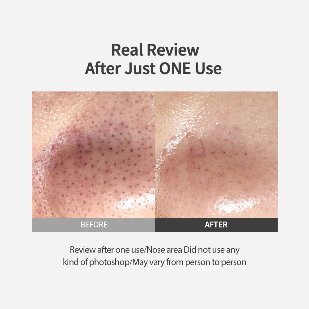 Sungboon Editor Blackhead Melting Clear Pad 65G(30 Counts) | Blackhead Remover Pad, Pore Minimizing | Deep Cleansing & Pore Uncl