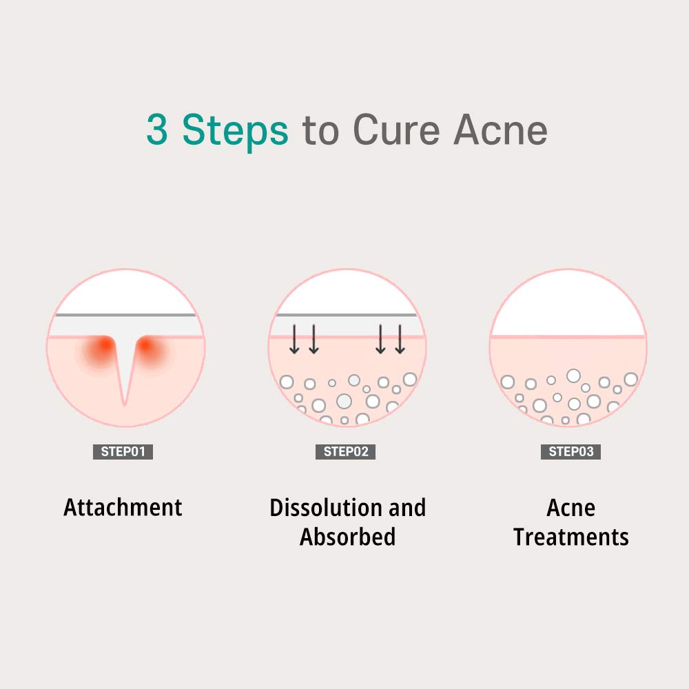 PATCH PRO Micro Pimple Patches Blemish Spot with Salicylic Acid and Skincare Ingredients - Needle Length 0.25mm Thin and Invisib