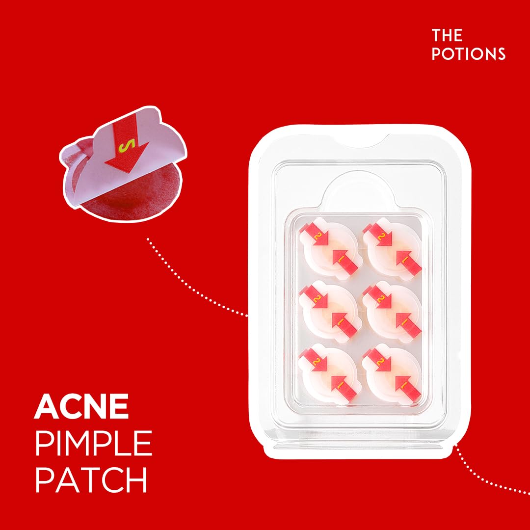 The Potions Acne Pimple Patch | Hydrocolloid Spot Patches for Facial Blemishes, Breakouts, Skin Protection, Acne Relief | 10 mm