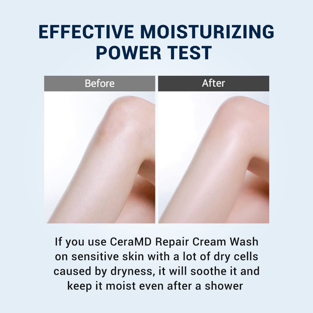 Derma B CeraMD Repair Cream Wash, Unscented Fragrance Free Creamy Face & Body Cleanser for Dry Sensitive Itchy Skin, Deep Moistu