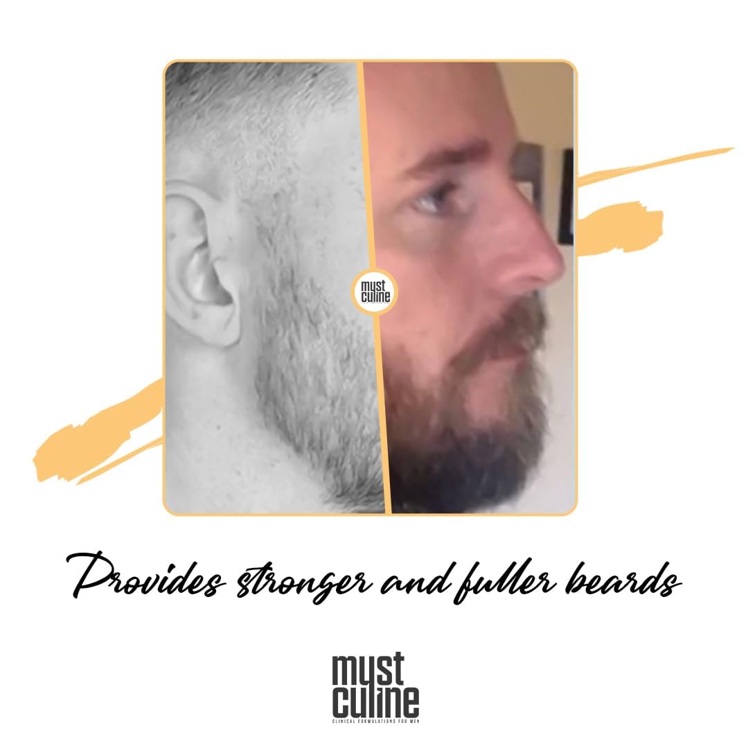 Mustculine Masculine Beard Growth Vitamin Spray For Fuller, Stronger, Longer, And Bushier Beards (2 Pack)