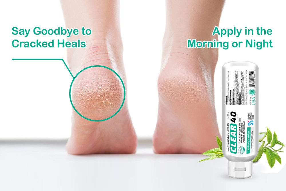 Clear 40, 40% Urea Gel, 8 Oz W/Tea Tree & Coconut Oil, Aloe Vera Extract, Works On Calluses & Corns, Moisturizes & Softens Crack
