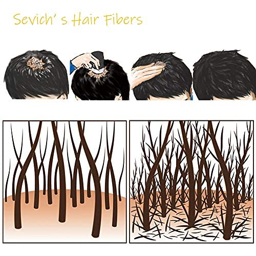 gowwim Hair Fibers for Thinning Hair 25g Hair Building Fibers 100% Undetectable,Instantly Cover Sparse Hair Areas-Bald Spots Cov