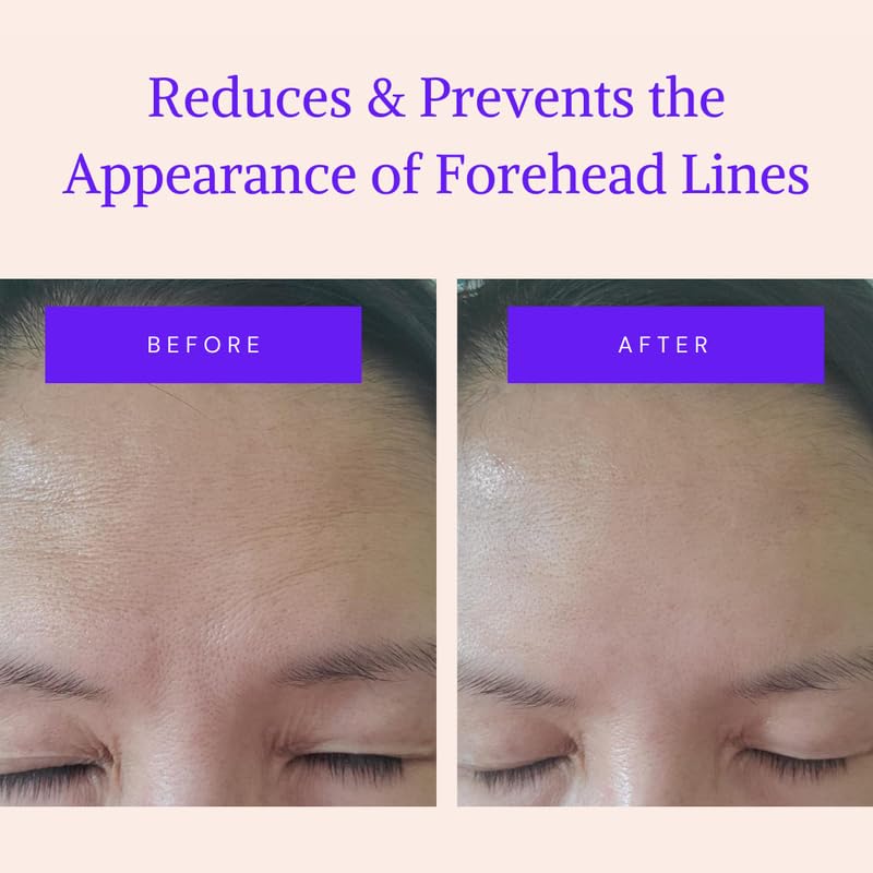 Blumbody Forehead Wrinkle Patches - Anti Wrinkle Facial Patches To Smooth Eyes & Forehead Wrinkles - Non-Silicone Face Tape For
