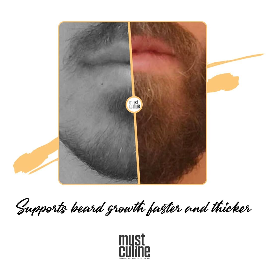 Mustculine Beard Shampoo Bar, Clean Your Beard With Growth And Hair Loss Effect, Hair Growth Shampoo Bar (4 Package)