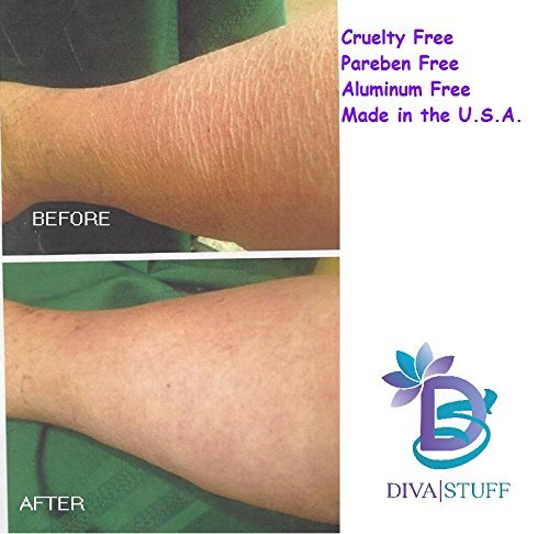 Diva Stuff Extreme Crepey Skin Body & Face Cream With Hyaluronic Acid, Alpha Hydroxy and More (Vanilla)