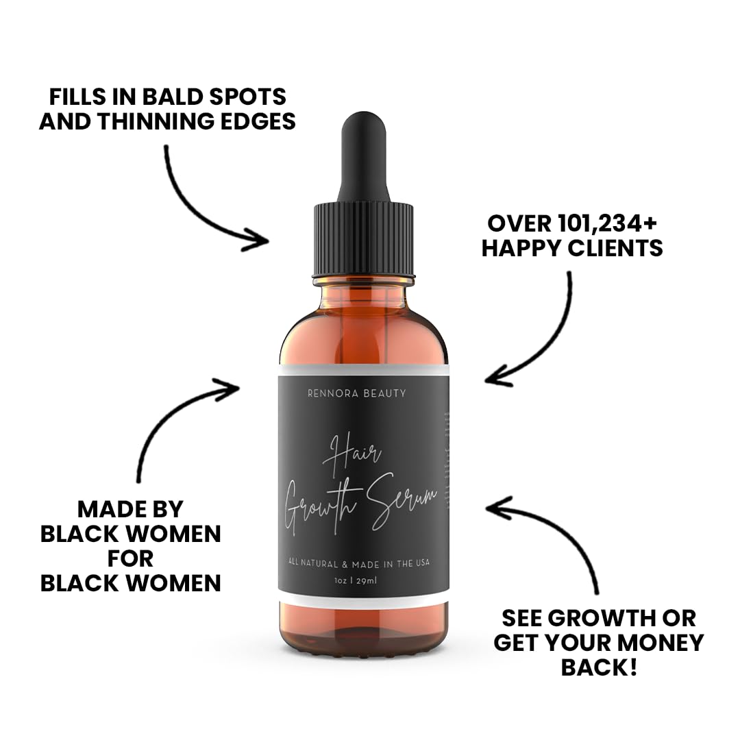 Rennora Hair Growth Serum With Organic Herbs And Natural Vitamins, Peppermint Oil, Stinging Nettle, And Rosemary Oil, No Chemica