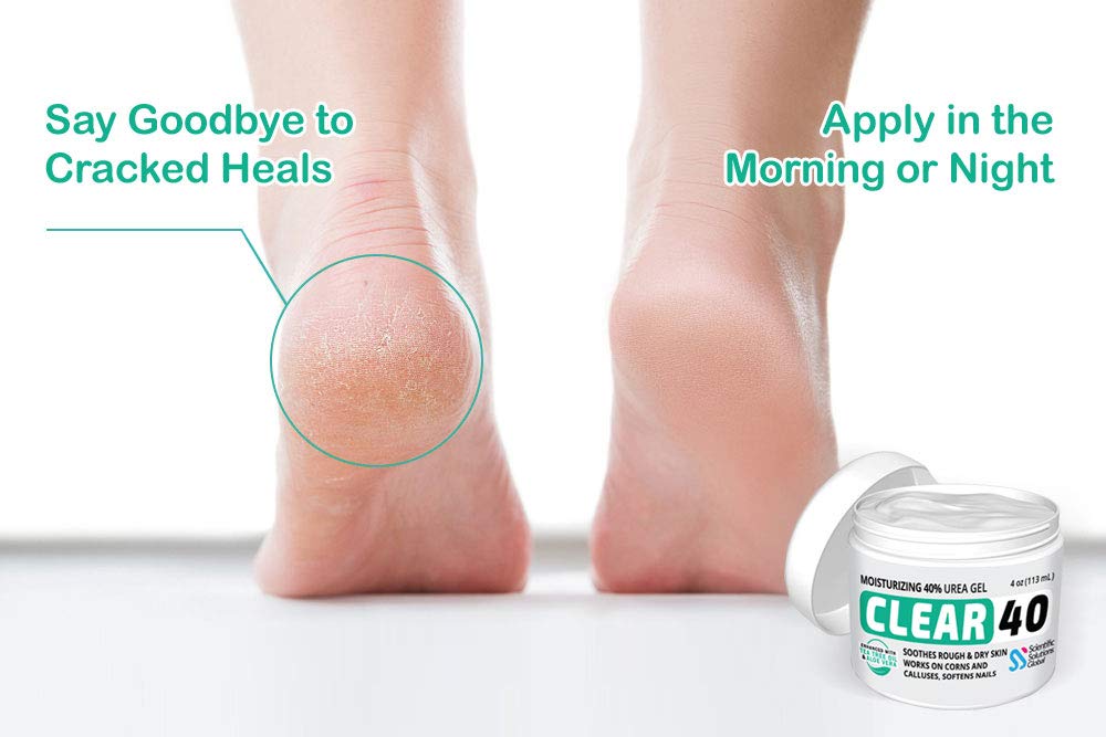 Clear 40 Urea Cream 40 Percent For Feet Maximum Strength (4Oz) | Softens Cracked Heels & Dry Skin Urea Cream 40 Percent - Tea Tr
