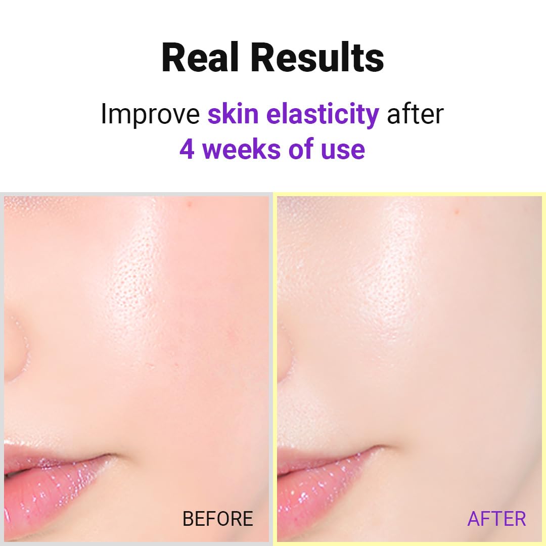 ISNTREE Hyper Retinol EX 1.0 Serum 20ml | 5 Peptides | 5 Cermaides | Helps Reduce Fine Lines