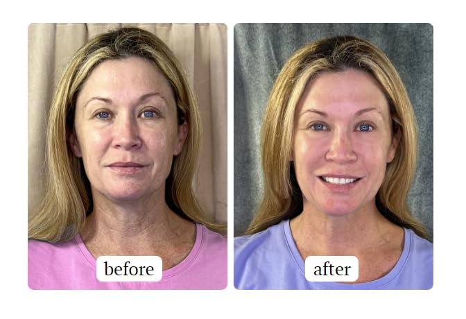 South Beach Skincare: All In One Anti-Aging Treatment 2.54 oz