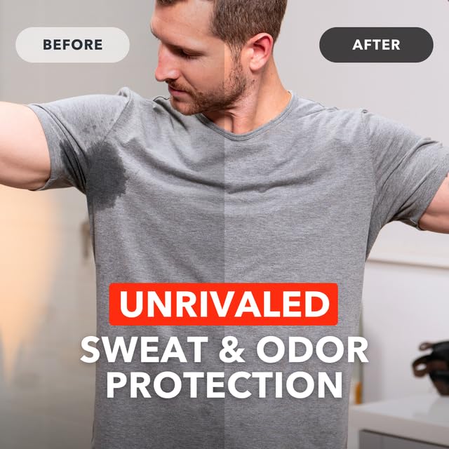 SweatBlock Antiperspirant Wipes - Maximum Clinical Strength - Treat Hyperhidrosis & Excessive Sweating for Men, Women, & Teens -