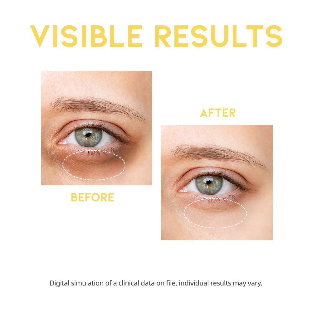 Dark Circle Remover Eye Serum, Eye Bags Treatment For Men And Women, Vitamin C, Niacinamide, Ceramide, Vegan Under Eye Treatment