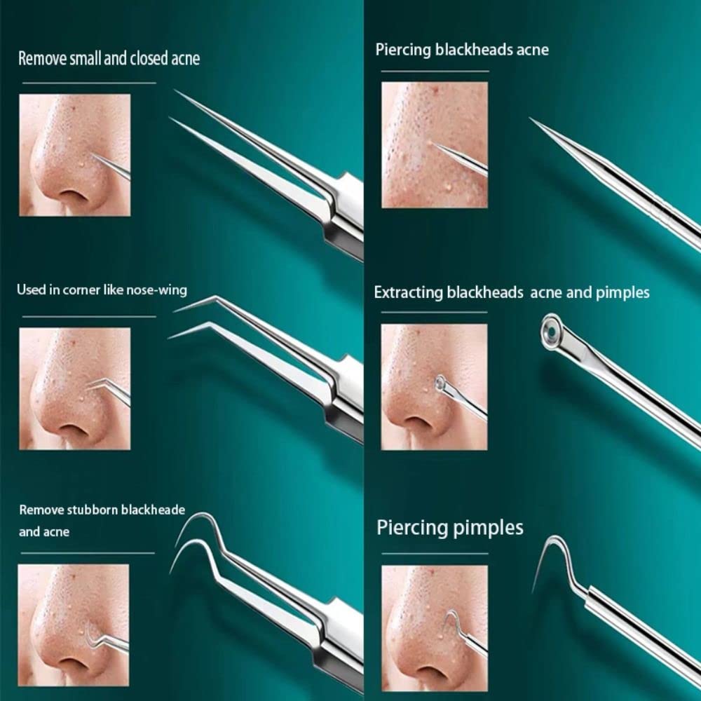 Andy's Orchids 3pcs/Set Blackhead Remover Tweezers, Pimple Remover Tweezers, Precision Pimple Popper Tool, Cell Clip Acne Needle