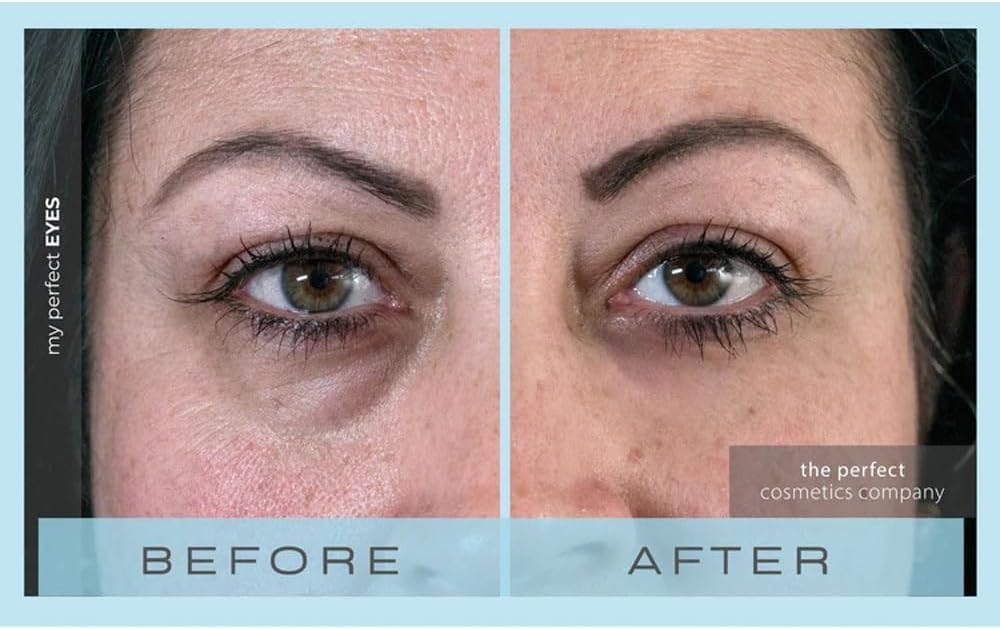 My Perfect Eyes 20Ml, 200 Applications, Penny Lane, Instant Results, Clinically Proven, Anti-Ageing Serum Uk Original Formula, S