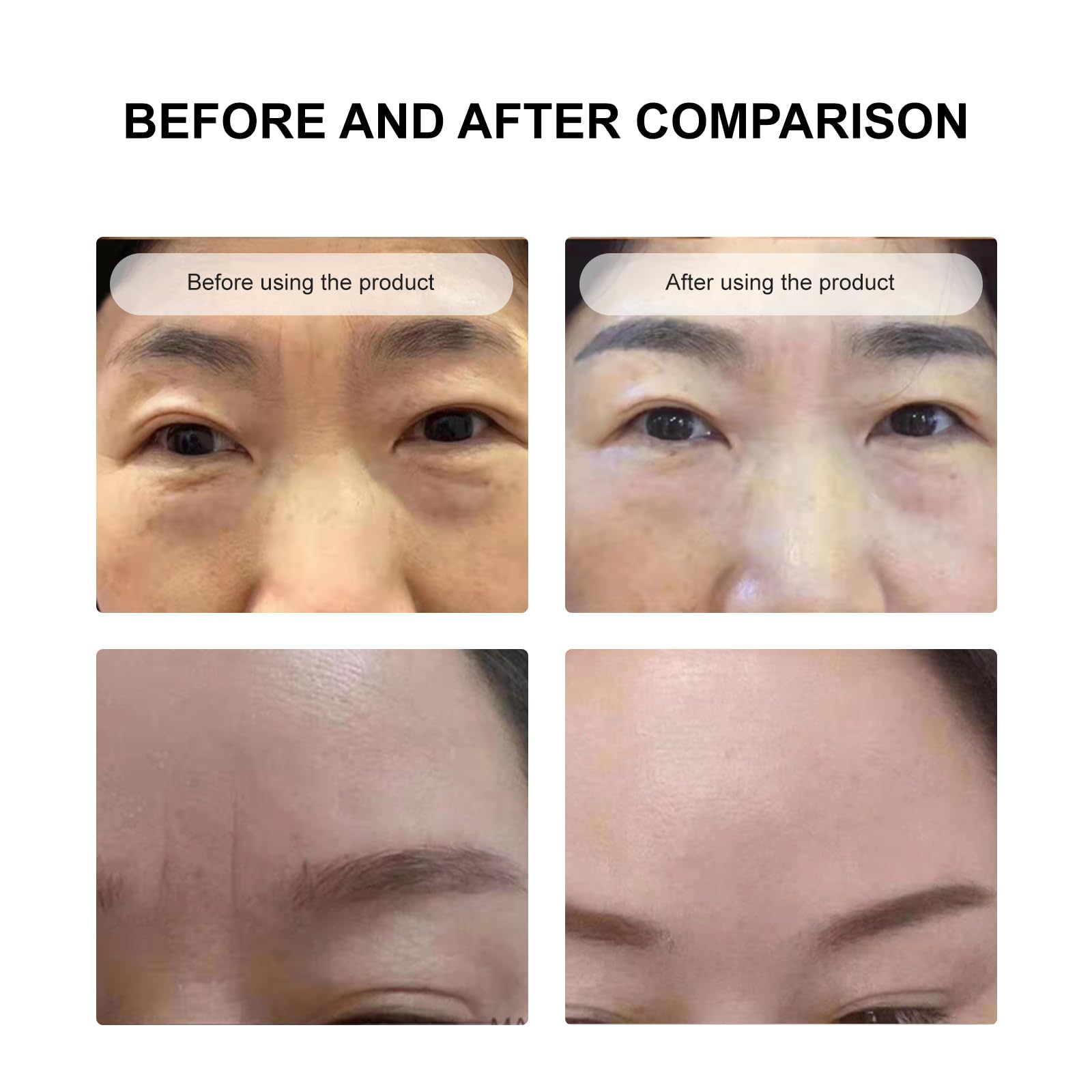 Secret Strips Facial Patches To Remove Wrinkle Between Eyes And Forehead Wrinkle Patches,Anti-Aging Face Masks For Women Skin Ca