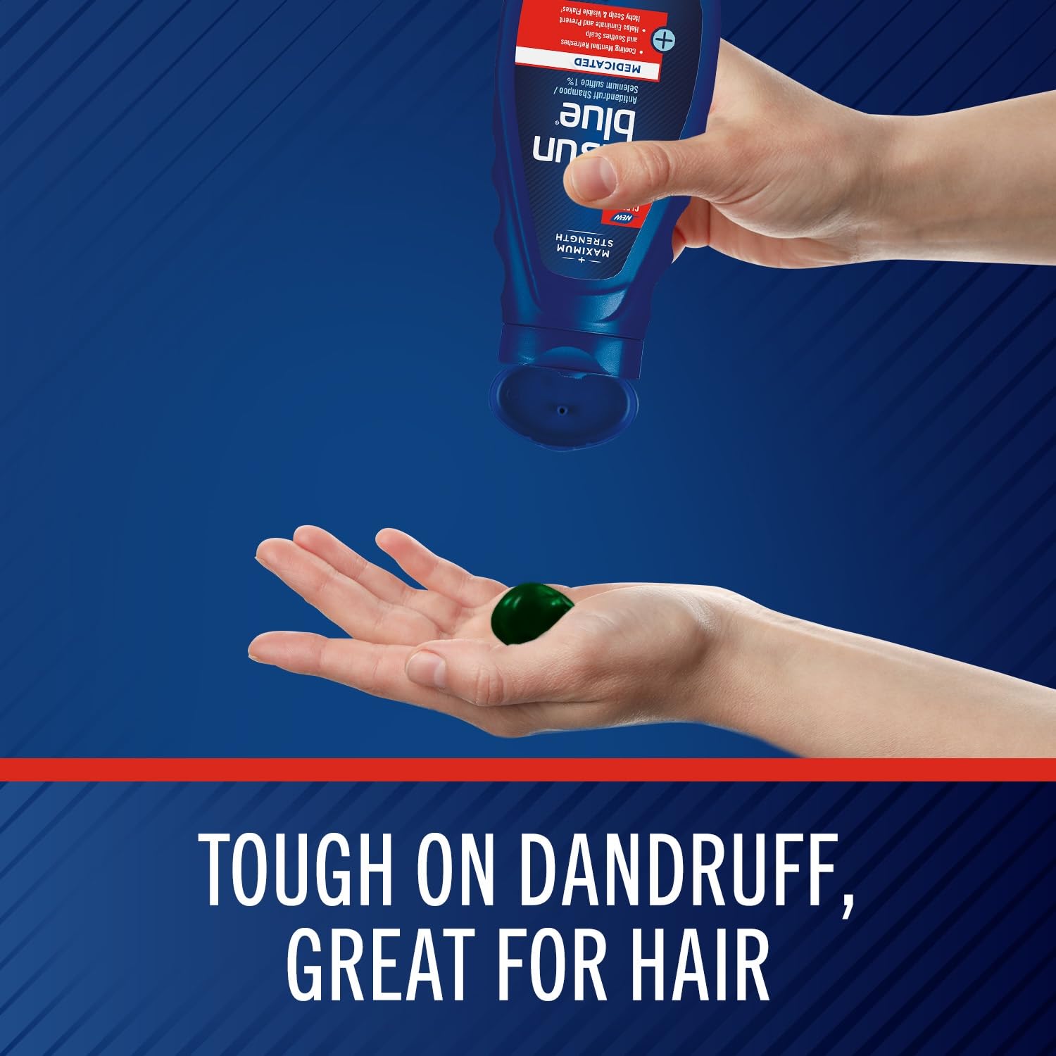 Selsun Blue Medicated Antidandruff Shampoo, Maximum Strength Scalp Treatment With Selenium Sulfide, 11 Fl. Oz.