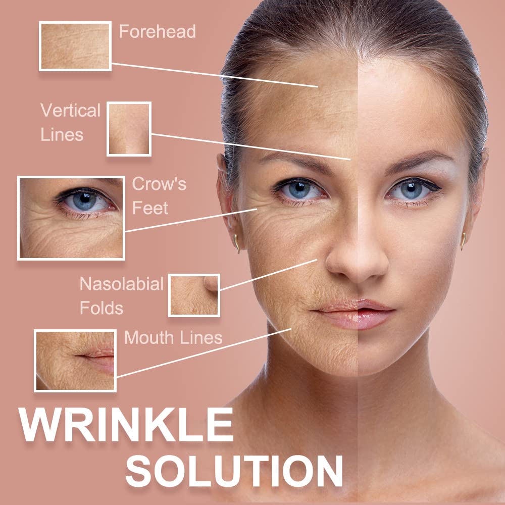 Akissos Face Tape Forehead Wrinkle Patches - Anti Lip Wrinkle Straw - Nose Lift - Facial Tape For Wrinkles - Eyes Neck Lips Wrin