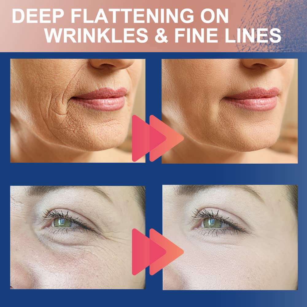 Akissos 2 Rolls Anti Wrinkle Patches Face Patches Neck Patches Unisex For Firming And Tightening Skin 2.5Cm*5M