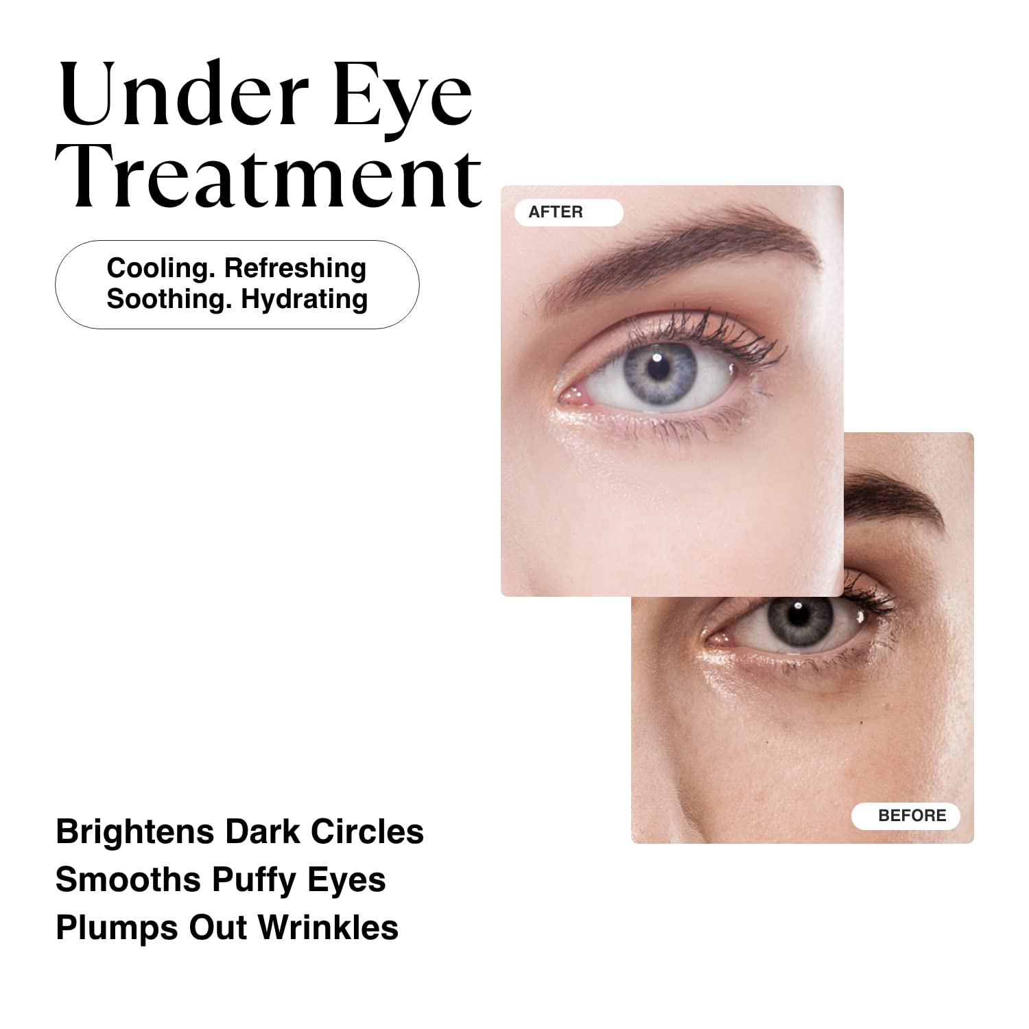 Matkas Korean Gold Under Eye Patches For Dark Circles And Puffiness, Wrinkles - Retinol + Hyaluronic Acid + Collagen + Niacinami
