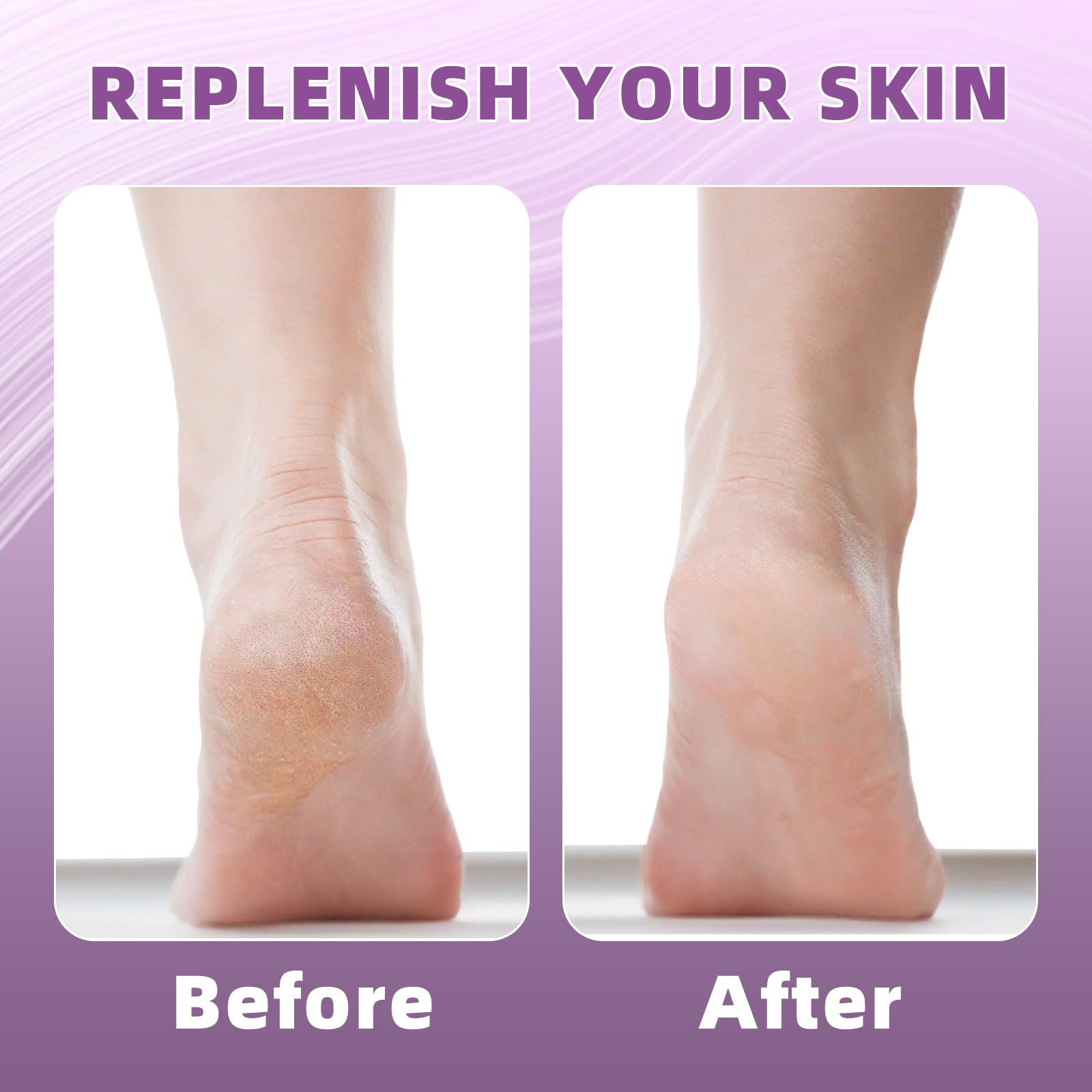 2 Pairs Silicone Socks for Dry Cracked Feet Women, Moisturizing Heel Socks, Gel Toeless Lotion Sock, Moisture Silicon Foot Sock