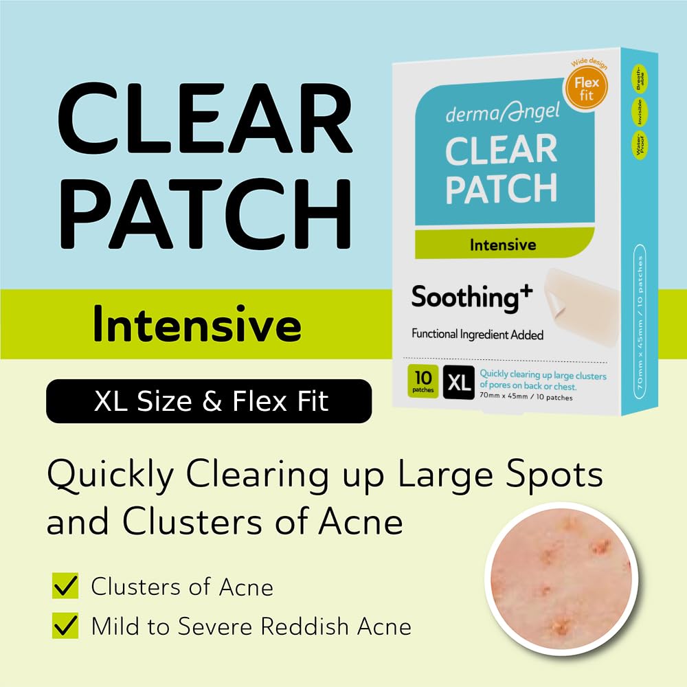 Derma Angel Large Pimple Patches For Face - Hydrocolloid Nose, Chin, And Forehead Acne Patches For Full Face Coverage - Big Acne