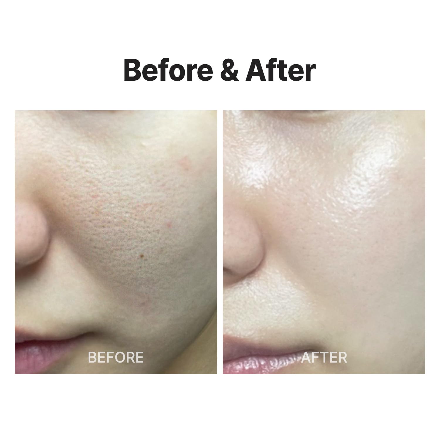 Meditherapy Wrinkle-Fit Mask (7Ea), Collagen Mask, Hydrating, Lifting Sagging Skin, Improving Elasticity, Hyaluronic Acid, Glass
