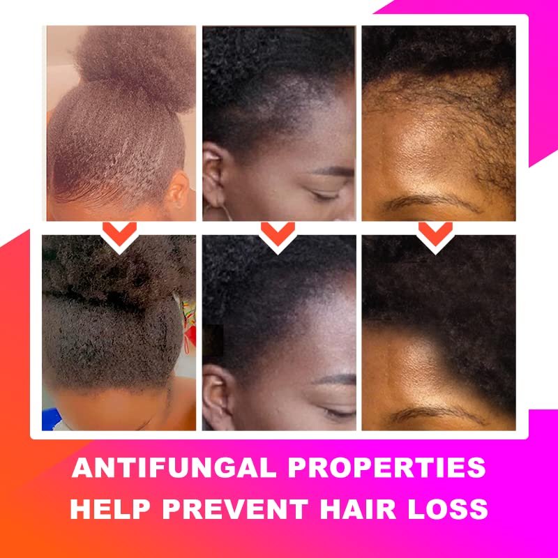 100% Naturals Chebe Hair Oil - Sevich African Chebe Powder Serum, Hair Loss Treatments Repair Damaged Moisture Hair Regrowth Tre