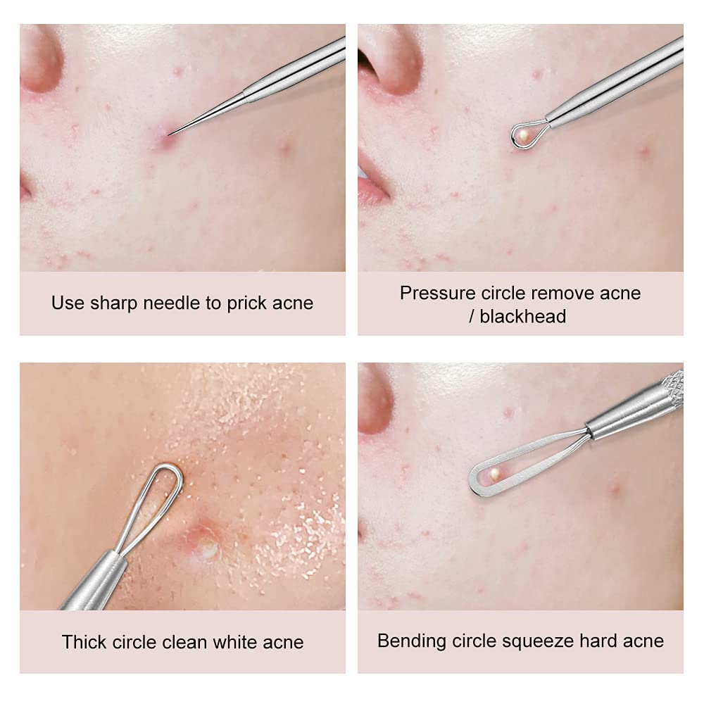 La Chat Blackhead Remover Tool Set - 2 PCS Stainless Steel Pimple Extractor, Risk-Free Treatment for Blemishes, Black