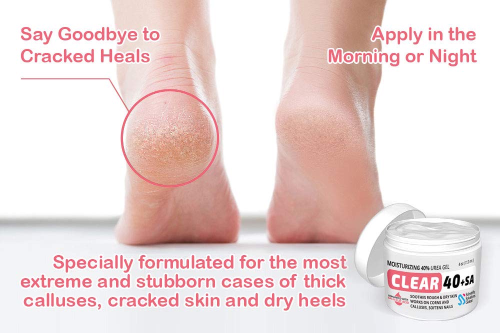 Scientific Solutions Global CLEAR Urea Cream 40% + 2% Salicylic Acid, 4oz - Softens Cracked Heels & Dry Skin, Tea Tree & Coconut Oil
