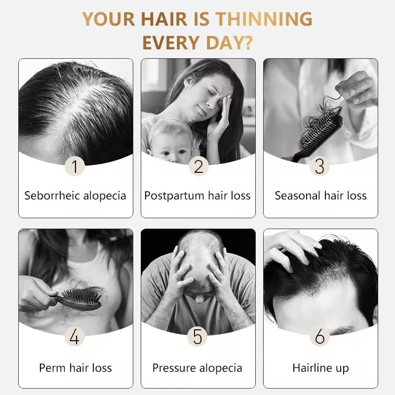 Dendas Biotin Hair Growth Serum - Anti-Hair Loss Essential Oil Treatment, Prevents Thinning, Repairs Dry & Frizzy Hair, Promotes