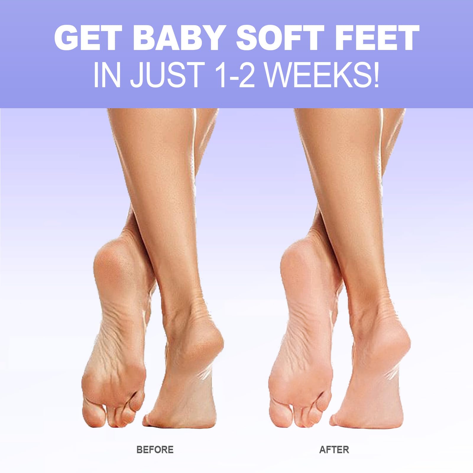 Foot Peel Mask - 3 Pairs - Exfoliating Peeling Callus Remover, Repairs Cracked Heels & Dead, Dry Skin, for Smoother and Softer F
