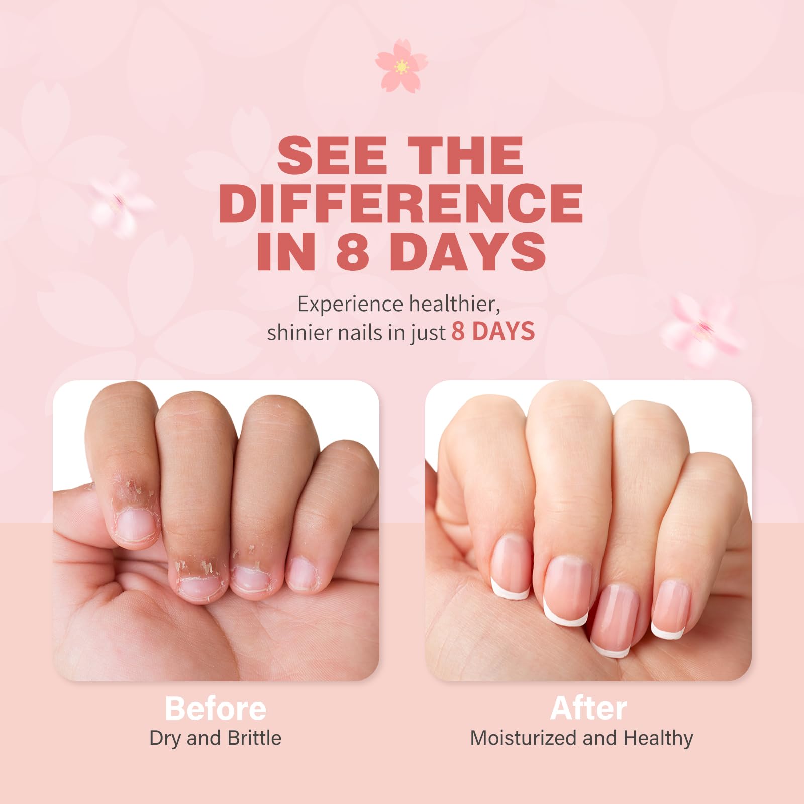 Cherry Blossom Nail & Cuticle Oil - Ultimate Hydration, Repair With Real Cherry Blossom Extract - Paraben-Free, Vegan & Cruelty-